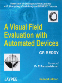 a visual field evaluation with automated devices , detection of glaucoma field defects with humbphrey field analyzer/swap/fdt-matrix