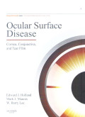 Ocular surface disease , cornea,conjunctiva, and tear film