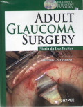 Adult glaucoma surgery