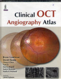 Clinical OCT angiography atlas