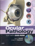 ocular pathology sixth edition