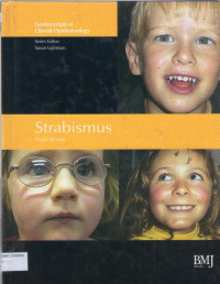 fundamentals of clinical ophthalmology,strabismus