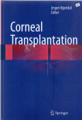 Corneal transplantation