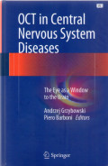 OCT in Central nervous system diseases (The eye as a window to the brain)