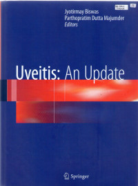 uveitis : an update