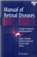 Manual of retinal diseases aguide to diagnosis and management